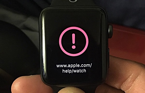 Nguyên nhân Apple Watch không cập nhật được phần mềm